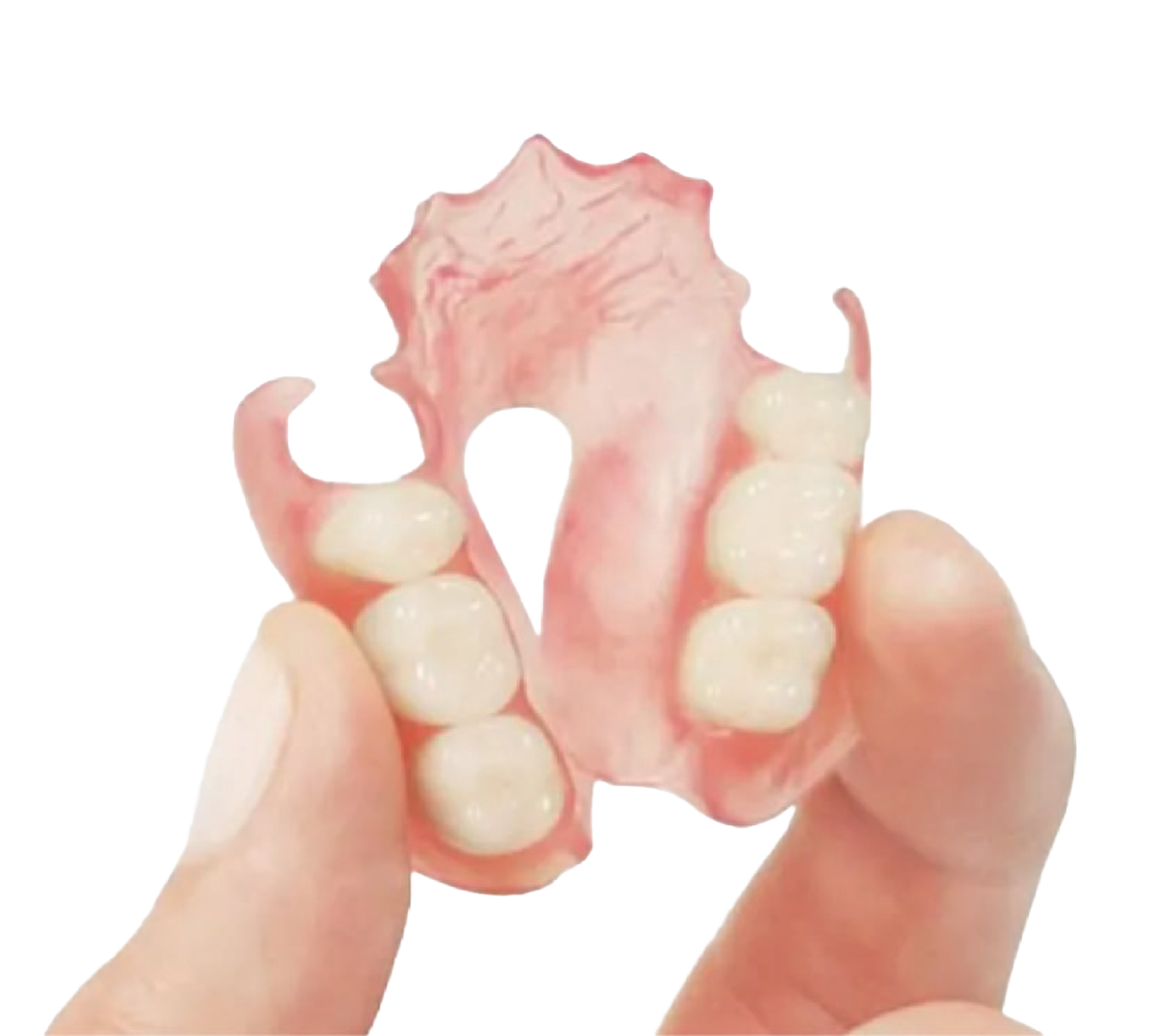 Flexible Denture